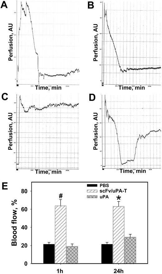 Figure 6. Prophylactic thrombolysis by scFv/uPA-T in venous thrombosis. Saline (A), untargeted uPA (B), or an equimolar dose of scFv/uPA-T (C-D) was injected intravenously in the jugular vein 1 or 24 hours before injury to the contralateral jugular vein by application of FeCl3. Explanations are as in Figure 5. Panel E shows analysis of the data collected from each group presented as percent of pre-injury level of the blood flow in the jugular vein during the first 30 minutes after induction of injury in mice pretreated with uPA or scFv/uPA-T 1 or 24 hours before the injury. In panel E, n = 9 per group, P < .05.