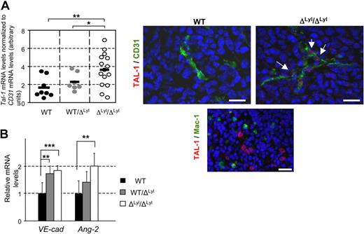 Figure 3. Up regulation of TAL-1, its VE-Cadherin target gene and Angiopoietin-2 in tumor vessels of Lyl1 -deficient mice. (A) Endothelial Tal-1 expression in LLC tumors implanted in ΔLyl1/ΔLyl1, WT/ΔLyl1 and WT mice. (Left) Total RNA was extracted from 1 or 2 pieces of tumors from mice of the 3 genotypes. Each point represents data for distinct piece of tumors: ΔLyl1/ΔLyl1 (14 pieces/9 tumors); WT/ΔLyl1 (7 pieces/5 tumors); WT (8 pieces/6 tumors). cDNAs were amplified in triplicate by specific Tal-1. Shown are normalized Tal-1 mRNA levels relative to CD31 mRNA levels (see supplemental Figure 1B) in each piece of tumor. The mean is represented as a black bar on this scatter plot. **P < .01; *P < .05. (Right) Immunofluorescence analysis of TAL-1 protein in LLC tumors from WT and ΔLyl1/ΔLyl1 mice. Representative microscopy images showing TAL-1 expression in the nucleus of endothelial cells boarding a blood vessel in a tumor of ΔLyl1/ΔLyl1 mice (white arrows), but not in tumor of their WT littermates. Tumor sections were double-stained for TAL-1 (red) and for blood vessel marker CD31 (green). Scale bar: 20 μm. (Bottom) TAL-1 expression in immature erythroid cells WT mice used here as positive control for TAL-1 staining. Spleen sections were double-stained for TAL-1 (red) and for the macrophage marker CD11b/CD18 (Mac1, green). Note the specific intense TAL-1 staining in the large nuclei of blast cells, but not in the smaller nuclei of lymphocytes or macrophages. Scale bar: 20 μm. (B) Total RNA was extracted from 1 or 2 pieces of tumors from mice of the 3 genotypes (as in panel A). cDNAs were amplified in triplicate by specific VE-cadherin or Ang-2 primers. VE-cadherin and Ang-2 mRNA levels were normalized to beta-Actin. Each bar is the mean ± SD of mRNA levels relative to mRNA levels of WT mice-derived, set arbitrarily at 1 ***P < .005; **P < .01