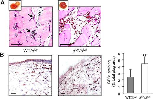 Figure 5. Increased angiogenesis in Matrigel plugs implanted in Lyl1-deficient mice. bFGF-containing Matrigel was subcutaneously implanted in both Lyl1-deficient and heterozygous mice (a total of 11 animals in each group in 2 experiments). Plugs were harvested at day 11, photographed (see supplemental Figure 4), and processed for histology. (A) Hematoxilin/Eosin staining of plug sections was visualized with a Nanozoomer slide scanner (Hamamatsu), and scanned images were analyzed with NDP.view software. Small insets show photograph of the corresponding Matrigel plug. Arrows indicate perfused small blood vessels in WT/ΔLyl1 plug section. Scale bars: 100 μm. (B) CD31 infiltration of Matrigel plugs: The entire surface of CD31-stained plug sections from ΔLyl1/ΔLyl1 and from their WT/ΔLyl1 littermates was visualized with a nanozoomer slide scanner controlled by the NDP.view software. (Left) Representative microscopy images of CD31 staining of plug sections from both genotypes. Scale bars: 100 μm. (Right) Entire plug sections were scanned and analyzed with ImageScope software (Aperio Technologies) using the “Positive Pixel count v9” algorithm. Shown is the quantification of CD31-staining expressed as a percentage of total plug surface. The data are presented as the mean ± SEM. Individual plugs from 2 independent experiments WT/ΔLyl1 (n = 7), ΔLyl1/ΔLyl1(n = 6), **P < .01.