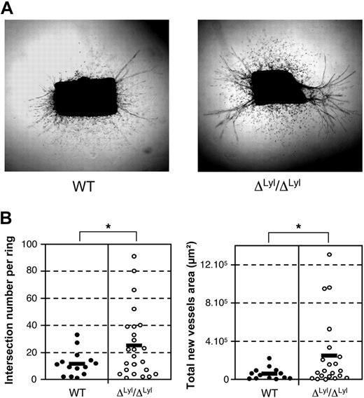 Figure 6. Lyl1-deficiency increases angiogenic potential of mice aortic explant. (A) Photomicrographs show the angiogenic response of a 5-day culture collagen-embedded thoracic aorta ring explants from ΔLyl1/ΔLyl1 and wild-type mice. Note the outgrowth of scattered myelofibroblast cells (α-SMA-positive cells, supplemental Figure 6) and endothelial tubules (CD31-positive cells, supplemental Figure 6) in both genotypes. (B) Images of microvessel outgrowth from aortic explants were captured at day 5 of culture with a Canon Powershot A650 digital camera mounted on an inverted phase contrast Axiovert25 microscope (Zeiss). The angiogenic response was determined for each individual aortic ring explant by quantifying the number of intersections of growing microvessels (left) and by measuring the total area occupied by the newly formed microvessels (right). Each point represents data for distinct fragment of aorta: WT (20 rings/4 mice) ΔLyl1/ΔLyl1 (30 rings/6 mice). The mean is represented as a black bar on this scatter plot. *P < .05.