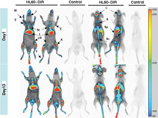 Figure 1. DiR allows sensitive NIR whole-body imaging tracking of human leukemic cells and analysis of their homing in immunocompromised recipients. HL60 cells (107) stained with 20μM DiR (HL60-DiR) were injected in 4 animals, whereas 2 controls were injected with unlabeled cells. At 24 hours after injection, 1 control and 2 animals injected with HL60-DiR were killed and prepared for whole-body imaging. Frontal acquisition (top left panel) and dorsal acquisition (top right panel) are displayed. The same operations have been realized 13 days after the injection (lower panels). The intensity settings for the acquisition and the processing of the images are identical for the 4 images. Fluorescence intensity scale is displayed on the right side of the images. J indicates jaws; St, sternum; E, elbow; L, liver; W, wrist; LN, lymph node; K, knee; F, foot; C, calvaria; S, scapula; Sc, spinal column; and Sp, Spleen.