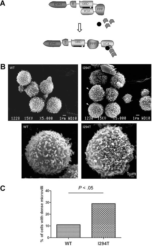 Figure 1. WASpI294T lymphocytes demonstrate dysmorphic microvilli. (A) Schematic showing the modular domain structure of WASp. Before activation, WASp adopts an autoinhibited conformation in which intramolecular interaction of the VCA and GBD domains prevents binding of the Arp2/3 complex and monomeric actin to the carboxy terminus. The I294T mutation (white star) lies in the critical VCA binding region (thick black line; amino acids 242-310) and is predicted to disrupt VCA interaction, resulting in constitutive activation. (B) SEM micrographs of lymphocytes from a healthy donor (WT) and a patient with WASpI294T. WASpI294T cells show dense and frequently dysmorphic microvilli (arrowheads and arrows). Scale bars represent 1 μm. Images were acquired using a JEOL 6100 SEM operating at 15 kV and captured using Semafore software and processed (crop and brightness/contrast functions only) with Adobe Photoshop. (C) Lymphocytes were scored blindly for dense microvilli by 2 independent observers. At least 50 cells were scored for each of WASpWT and WASpI294T cells. A significantly greater percentage of WASpI294T cells assembled dense microvilli (P < .05 Fisher exact 1-tailed test).
