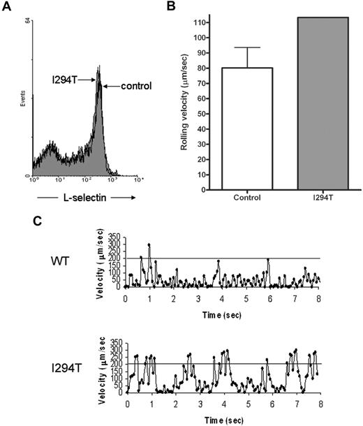 Figure 2. WASpI294T PBMCs demonstrate defective L-selectin–dependent rolling despite normal levels of surface L-selectin. (A) WT and WASpI294T PBMCs were freshly isolated from whole blood and monitored for surface L-selectin expression by flow cytometry. Histogram gated on PBMCs reveals comparable levels of L-selectin between patient and control samples. (B) A fixed density of patient or control PBMCs (ie, 3 × 105/mL) were perfused over immobilized sLex at 2.5 dyn/cm2. A single patient sample was analyzed, whereas 3 control samples were analyzed; the average of 3 independent experiments is represented in the histogram. Approximately 30 cells were analyzed per field of view, and an average of 100 cells was analyzed per experiment. Error bar represents SD. (C) Representative example of the jerky nature of PBMC rolling from control and patient samples. Individual cells were tracked for a total of 8 seconds. The superimposed line represents a velocity of 200 μm/s, which is the velocity threshold above which cells are normally considered to be in free flow.