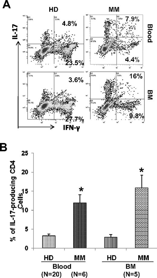 Figure 2. Increased frequency of induced Th17 cells in myeloma. Purified naive CD4 cells from peripheral blood mononuclear cells (PBMCs) and bone marrow mononuclear cells (BMMCs) were polarized with Th17 cocktail for 12 days. After restimulation with PMA and ionomycin, IL-17–expressing cells were measured by intracellular IL-17 staining using flow cytometry. (A) A representative dot plot analysis shows IL-17– and IFN-γ–expressing cells as percentage of CD4 cells in peripheral blood and BM samples from HD and myeloma (MM) patients. (B) Composite results presented as mean values with SEM for IL-17–expressing cells within CD4 population. *P < .05.