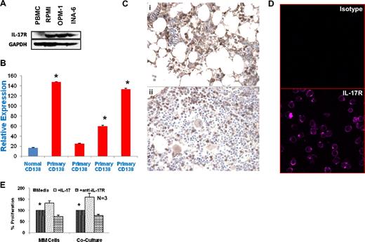 Figure 5. Significant expression of IL-17 receptor in myeloma cells. (A) Total cell lysates were prepared from MM cells, and separated by electrophoresis on 5% to 20% polyacrylamide gradient gels. Samples were probed with antisera to IL-17 receptor and GAPDH as indicated. (B) RNA was isolated from purified primary MM cells and qPCR was performed as described in “Quantitative PCR for IL-17 and IL-17R expression.” Results are presented as relative expression value. *P < .05. (C) Paraffin-embedded tissue sections from MM patients (N = 10) were stained using anti–IL-17R antibody as described in “Immunohistochemistry” and evaluated using a Nikon transmitted light microscope. The majority of the MM cells are positively stained with IL-17R receptor antibody in 7 of 10 patients. Two representative stained sections are shown at 200× magnification. (D) Myeloma cell lines were stained with isotype control antibody (top panel) or anti–IL-17R antibody (bottom panel) and analyzed by confocal microscopy. One representative cell line of 4 experiments is shown at 640× magnification. (E) MM cell lines (N = 3) were cultured alone or cocultured with BMSCs with or without IL-17 in the presence or absence of anti–IL-17R antibody. Proliferation was measured by 3H-thymidine incorporation after 3 days. Data are presented as percentage proliferation in the presence of IL-17 or IL-17R antibody compared with control and shown as mean plus or minus SEM. *P < .05.