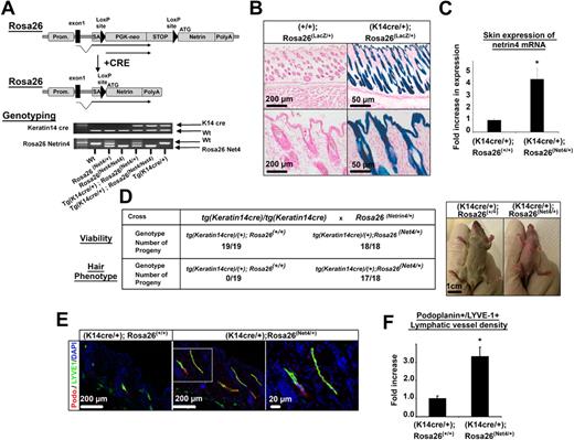 Figure 3. Netrin-4 overexpression in mouse skin results in an increased lymphatic density. (A) Schematic of the Netrin-4 overexpression system and genotyping of the various mice. Netrin-4 cDNA was inserted into the constitutively active Rosa26 locus downstream of a LoxP-flanked transcriptional stop signal. In presence of a cre recombinase driven by the keratin14 promoter (indicated as Prom.), the stop signal is excised allowing expression of Netrin-4. (B) Expression of the LacZ gene reporter (Rosa26 LacZ/+) in mouse skin keratinocytes in presence of the Keratin14 cre recombinase (K14 cre/+). Scale bars: 200 and 50 μm. (C) Quantification of Netrin-4 mRNA by qRT-PCR in the skin of Netrin-4–overexpressing mice versus littermate controls. (D) Three-week-old skin-overexpressing Netrin-4 mice are viable but hairless, smaller, and redder than controls (scale bar: 1 cm). Pictures were taken on an Olympus IX71 microscope, at 100× and 400× magnification using a DP30BW Olympus camera and the MicroSuite Basic Edition Olympus software. (E) Skin sections of 3-week-old Netrin-4–overexpressing and littermates control mice costained with an anti–LYVE-1 and an antipodoplanin (indicated as podo.) antibody (dotted box represents the enlarged area shown; scale bars: 200 and 20 μm). (F) Quantification of the LYVE1+/podoplanin+ staining density using ImageJ and normalized to the control group. Pictures in panel E are representative of the quantification reported in panel F.
