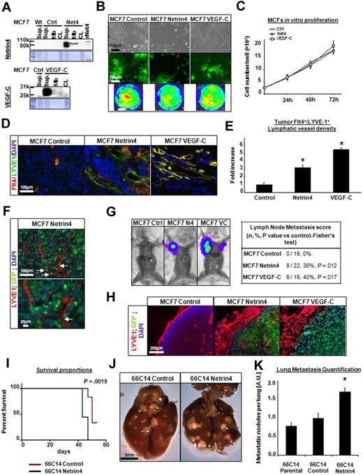 Figure 4. Netrin-4–overexpressing MCF7 tumors have more lymphatic vessels and are more metastatic. (A) Human breast cancer MCF7 cells (WT) stably transduced with a Netrin-4 (Net4), VEGF-C or empty vector (control). Protein expression was determined in the cell supernatant (SUP), the fraction secreted and bound to the cytoplasmic membranes (Mb) or in the total cell lysate (CL) by Western blot using an anti–Netrin-4 or an anti–VEGF-C antibody. (rNet4; Recombinant Netrin-4). All control, Netrin-4, and VEGF-C MCF7 tumor cells also express at similar levels both GFP and luciferase (B) and proliferate in vitro at an identical rate (C; Ctrl; control empty vector, Net4; Netrin-4; scale bars in panel B: 100 μm and 1 cm). (D) Control, Netrin-4, and VEGF-C–overexpressing MCF7 cells injected subcutaneously into the midline of the back of NOS/SCID mice. Tumors were removed after 12 weeks, sectioned and costained with an anti–VEGFR-3/Flt-4 and anti–LYVE-1 antibody (scale bar: 100 μm). (E) VEGFR-3+/LYVE-1+ costaining density was quantified using ImageJ and represented as fold increase over the control-empty vector tumor condition. (F) GFP-positive tumor cells in the lumen of tumor lymphatic vessels stained with LYVE-1 antibody in the Netrin-4–overexpressing tumors (scale bars: 100 and 20 μm). (G) Luciferase-positive tumor cells metastasized into the auxillary lymph nodes of the Netrin-4 and VEGF-C tumor-bearing mice. (H) luciferase-positive lymph nodes contain GFP-positive tumor cells and are surrounded by enlarged LYVE-1 stained vessels in mice bearing Netrin-4 and VEGF-C–overexpressing tumors, but not in control condition (scale bar: 200 μm). 66C14 murine mammary carcinoma line metastasizing via the lymphatic system to lungs were stably transfected with a Netrin-4 encoding or empty-vector and injected into the exposed inguinal right mammary fat pad of Balb/C mice. Netrin-4–overexpressing 66C14 tumor bearing mice die faster than controls (I) and present more metastatic nodules per lung (J; scale bar: 5 mm). Pictures were taken on an Olympus IX71 microscope, at 100×, 200×, and 400× magnification using a DP30BW Olympus camera and the MicroSuite Basic Edition Olympus software. The number of metastatic nodules per lung was quantified by visual inspection (K). *P < .05.