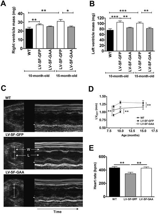 Figure 3. Effect of LV-SF-GAA HSC transplantation on cardiac structure and parameters. (A-B) Response of cardiac hypertrophy to LV-SF-GAA transplantation. The right and left ventricular mass of 10-month-old (n = 6 in all groups) and 15-month-old (n = 5 for LV-SF-GFP and n = 7 for LV-SF-GAA) mice that received a transplant of LV-SF-GFP is significantly higher than for WT mice. The left ventricular mass of mice that received a transplant of LV-SF-GAA is significantly lower than for the age-matched mice that received a transplant of LV-SF-GFP. The same holds for the right ventricular mass at month 15 (*P < .05, **P < .01, or ***P < .01 indicate a significant difference between groups). (C) Representative ultrasound images display the short axis of the left ventricle (left, 2-dimensional guided; right, M-mode) of WT and Gaa−/− mice that received a transplant of LV-SF-GFP and LV-SF-GAA (W indicates ventricular wall; L, left ventricular lumen). The Gaa−/− mice that received a transplant of LV-SF-GFP display a larger left ventricular wall thickness than the WT mice and mice that received a transplant of LV-SF-GAA, both at end diastole and at end systole (not shown). Furthermore, it shows that mice that received a transplant of LV-SF-GFP have a lower heart rate than both the WT mice and mice that received a transplant of LV-SF-GAA by the increased duration of the cardiac cycle. (D) The left ventricular wall thickness at end diastole (LVEDT) in LV-SF-GFP–treated mice (n = 6) is increased compared with WT mice at 8 and 10 months of age (n = 6). Reduction of LVEDT is accomplished in mice that received a transplant of LV-SF-GAA compared with LV-SF-GFP–treated mice at 8 (n = 6), 10 (n = 6), and 15 months of age (n = 3) (**P < .01). (E) Relative heart rate normalized after LV-SF-GAA treatment. At 10 months of age LV-SF-GFP–treated mice (n = 10) had a lower than normal (WT mice; n = 11) heart rate. Treatment with LV-SF-GAA (n = 11) normalized the heart rate (**P < .01). BPM indicates beats per minute.