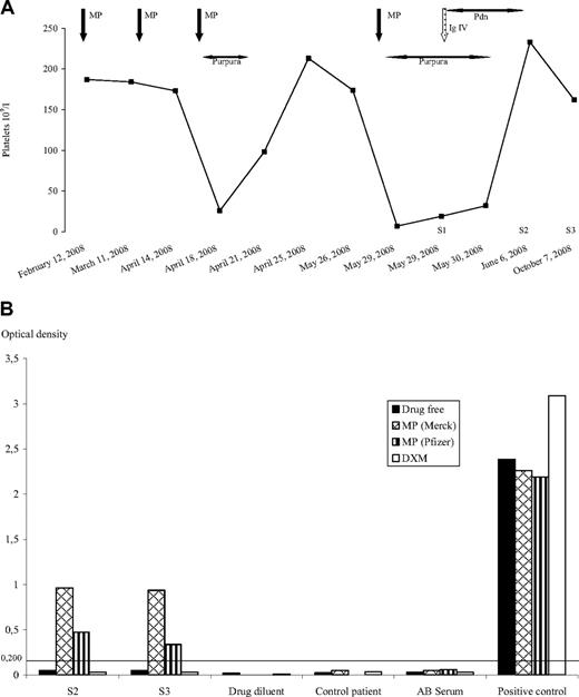 Figure 1. Detection of drug-dependent antibodies. (A) Platelet count evolution. (B) Monoclonal antibody-specific immobilization of platelet anti-gene (MAIPA). Platelet antibodies were characterized using CD41 antibodies to immobilize the platelet GpIIb/IIIa. Human platelet antibodies were detected by a peroxidase-conjugated goat anti–human IgG Fcγ fragment. Optical density (OD) at 492 nm was considered negative at less than 0.2 OD units. Negative controls comprised group AB serum and the drug diluent (saline serum). Human polyclonal sera containing anti–HPA-1a, anti–HPA-5b or anti-GpIb/IX activity served as positive controls. S1 volume was insufficient for MAIPA. In assays, drugs were added to incubation and wash solutions at final concentrations of 0.05, 0.1, and 0.2 mg/mL MP, and 0.002, 0.004 and 0.008 mg/mL dexamethasone (DXM). S1, S2, and S3 serum samples. DXM indicates dexamethasone; MP, methylprednisolone; IgIV, intravenous immunoglobulins; and Pdn, prednisolone.
