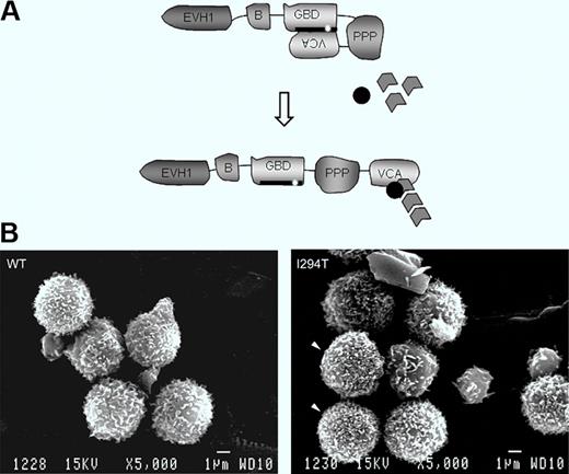 Schematic showing WASP autoinhibition in normal resting cells and conformational activation. The patient's mutation is indicated. Bottom: Lymphocytes of a normal healthy donor and WASPI294T lymphocytes of the patient. See the complete figure by Burns et al beginning on page 5355.