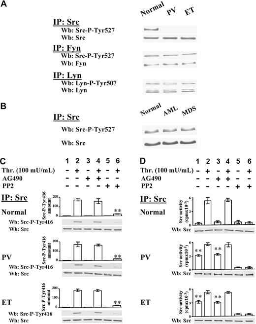 Figure 3. Analysis of Src activation state in resting and thrombin-stimulated platelets. (A) Platelets, isolated from healthy donors or PV and ET patients, were lysed in IP-buffer and immunoprecipitated with anti-Src, anti-Fyn, or anti-Lyn antibodies. Src-IPs and Fyn-IPs were immunostained with anti–Src-P-Tyr527 antibody, which recognizes the phosphorylated C-terminal sequence of both kinases, and then reprobed with anti-Src or anti-Fyn antibody, respectively. Lyn-IPs were immunostained with anti–Lyn-P-Tyr507 antibody and reprobed with anti-Lyn antibody. The Western blots of Src-IPs are representative of experiments performed with 14 normal samples, 10 PV (JAK2V617F either homozygous or heterozygous), and 18 ET JAK2V617F negative and positive; the Western blots of Fyn-IPs and Lyn-IPs are representative of experiments performed with 4 normal and 4 ET samples. (B) Src kinase was immunoprecipitated from platelet lysates of 5 healthy donors, or 3 AML and 5 MDS patients. Src-IPs were immunostained with anti–Src-P-Tyr527 antibody and then reprobed with anti-Src antibody. (C-D) Platelets, isolated from healthy donors, and PV or ET patients, were incubated with vehicle (lanes 1,3,5) or 100 mU/mL thrombin (lanes 2,4,6) for 1 minute, in the absence (lanes 1-2) or presence of 10μM AG490 (lanes 3-4), or 10μM PP2 (lanes 5-6). Platelets were then lysed in IP-buffer and immunoprecipitated with anti-Src antibody. (C) Src-IPs were analyzed by Western blot with an antibody raised against the Src sequence containing the phospho-Tyr416. Means of densitometric values are reported above the Src-P-Tyr416 bands. Blots were then reprobed with anti-Src antibody. **P < .001 versus Src-P-Tyr416 present in platelets stimulated in the absence of inhibitors. (D) Src-IPs were analyzed for in vitro kinase activity toward the Src-specific peptide substrate cdc2(6-20) as described in “In vitro tyrosine kinase assays.” Samples were subjected to SDS/PAGE and the gels were analyzed for the radioactivity incorporated in the peptide by a Packard Cyclone (columns of the panel). The gels were then blotted and immunostained with anti-Src antibody. Panels C and D are representative of experiments performed with 12 normal samples, 10 PV (JAK2V617F either homozygous or heterozygous), 18 ET JAK2V617F negative or positive. **P < .001 versus resting normal platelets.