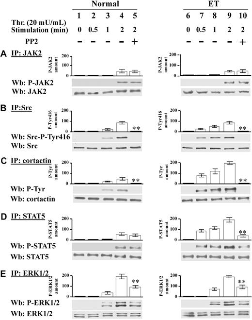 Figure 5. Time course of JAK2 and Src signaling triggered by 20 mU/mL thrombin. (A-E) Normal (1-5) or ET platelets (6-10) were challenged with 20 mU/mL thrombin for the indicated time in the presence of vehicle (lanes 1-4, 6-9), or 10μM PP2 (lanes 5,10). (A) Platelets were lysed in IP-buffer and immunoprecipitated with anti-JAK2 antibody and the IPs were subjected to SDS/PAGE, blotted and immunostained with anti–P-JAK2 antibody, stripped, and reprobed with anti-JAK2 antibody. (B) Platelet lysates were immunoprecipitated with anti-Src antibody and the IPs were immunostained with the phospho-specific anti–Src-P-Tyr416 antibody, and reprobed with anti-Src antibody. (C) Platelet lysates were immunoprecipitated with anticortactin antibody and the IPs were immunostained with anti–P-Tyr antibody, and reprobed with anticortactin antibody. (D) IPs obtained by treatment with anti-STAT5 antibody were immunostained with anti–P-STAT5 antibody, and reprobed with anti-STAT5 antibody. (E) IPs obtained with anti-ERK1/2 antibody were immunostained with anti–P-ERK1/2 antibodies, and reprobed with anti-ERK1/2 antibody. Means of densitometric values are reported above the relative phosphorylated bands. Panels A, C, and D are representative of experiments performed with 12 normal and 16 ET samples either JAK2V617F negative or positive, whereas panels B and E are representative of experiments performed with 6 normal and 6 ET samples either JAK2 V617F negative or positive. **P < .001 versus the relative protein Tyr phosphorylation detected after 2 minutes of thrombin stimulation in the absence of PP2.
