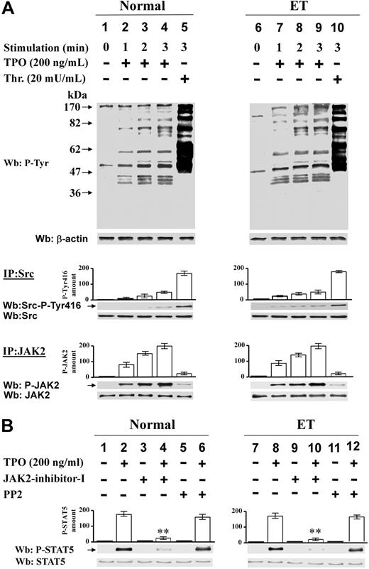 Figure 7. Effect of TPO on Src and JAK2 activation in normal and ET platelets. (A) Platelets from healthy donors (lanes 1-5) or ET patients (lanes 6-10) were treated with 200 ng/mL TPO (lanes 2-4, 7-9) or 20 mU/mL thrombin (lanes 5,10) for the indicated times. Cells were lysed and aliquots of the lysates were analyzed by Western blot with anti–P-Tyr antibody (top part of the panel). Platelets were lysed in IP-buffer. Aliquots of the lysates were immunoprecipitated with anti-Src antibody and the IPs were immunostained with anti–Src-P-Tyr416 and reprobed with anti-Src antibodies (middle part of the panel). Aliquots of the lysates were immunoprecipitated with anti-JAK2 antibody and the IP were immunostained with anti-P-JAK2 antibody and reprobed with anti-JAK2 antibody (bottom part of the panel). Means of densitometric values relative to the phosphorylated kinases are reported above the relative bands. (B) Platelets from healthy donors (lanes 1-6) or ET patients (lanes 7-12) were treated without (odd lanes) or with (even lanes) 200 ng/mL TPO for 2 minutes in the absence (lanes 1-2, 7-8), or presence of 1μM JAK-inhibitor-I (lanes 3-4, 9-10), or 10μM PP2 (lanes 5-6, 11-12). Platelet lysates were analyzed by Western blot with anti–P-STAT5 antibody and reprobed with anti-STAT5 antibody. Densitometric values of anti–P-STAT5 are reported above the relative bands and are means of data obtained from 6 normal, 3 JAK2V617-negative, and 3 JAK2V617-positive ET samples. **P < .001 versus STAT5 phosphorylation in the absence of inhibitors.