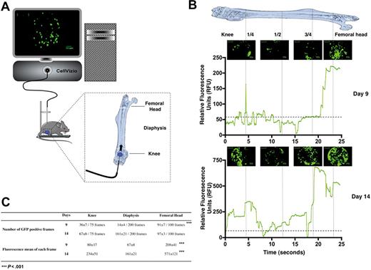 Figure 1. In vivo monitoring of hematopoietic reconstitution. (A) Schematic drawing represents the fluorescence confocal endoscope system (CellVizio, MKT) equipped with the S300 flexible microprobe containing 10 000 optical fibers that carry light from a continuous laser source at 488 nm to the living tissue. The distribution of transplanted fluorescent hematopoietic cells was monitored through the femur of living mice from the knee to the femoral head using video data acquisition software (IC-Viewer, MKT). (B) At 24 hours after irradiation at 10 Gy, C57BL/6 recipient mice were transplanted with 1000 GFP+ LSKCD34− sorted cells. Nine (top panel) and 14 (bottom panel) days after transplantation, the GFP+ hematopoietic cell tracking was performed. Pictures representative of GFP+ hematopoietic cells present in the knee, diaphysis, and femoral head areas are shown. These pictures represented frames of 30 to 50 seconds acquired videos over the length of the femur. Scale bar represents 50 μm. The graphics shown below the pictures represent the mean of the relative fluorescence units detected over the time in the femur by the 10 000 optical fibers per individual video frame. The vertical strokes indicate different positions of the microprobe tip in the femoral cavity. Only relative fluorescence units in excess of a value of 60 is considered a positive signal. Note the scale difference between the relative fluorescence units detected 9 and 14 days after transplantation. These data are representative of 5 to 10 independent experiments. (C) Quantification and fluorescence mean of the images obtained 9 and 14 days after transplantation of 1000 GFP+ LSKCD34− hematopoietic cells. Seventy-five, 200, and 100 video frames were studied in the knee, the diaphysis, and the femoral head, respectively. The number of GFP+ frames and the fluorescence mean of each frame are indicated for each femoral compartment. These data are representative of 5 to 10 independent experiments. Statistical analysis was performed with the 1-way analysis of variance test.