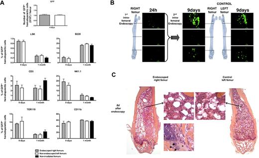 Figure 2. Analysis of femoral hematopoietic reconstitution after endoscopy. At 24 hours after irradiation at 10 Gy, C57BL/6 recipient mice were transplanted with 1000 LSKCD34− GFP+; and 1 day later, an endoscopy was performed in the right femur of the recipient mice. (A) Eight days and 1 month after this first endoscopy, mice were killed, bone marrow from right and left femurs was flushed, and the GFP+ cells were counted by FACS analysis (8 days after endoscopy) and phenotyped by FACS analysis (8 days and 1 month after endoscopy). Graphics show the number of GFP+ cells present in right and left femurs 8 days after the endoscopy of the right femur and the percentage of immature hematopoietic cells (LSK), lymphocytes (B220, CD3, and NK1.1), myelocytes (CD11b), and erythrocytes (Ter119) found in the bone marrow of the right and left femurs of mice 8 days and 1 month after endoscopy. The percentage of GFP+ cells found in the different hematopoietic populations of a femur from nonirradiated and nonendoscoped mice is also shown (n = 5 for each group of mice). Error bars represent SEM. (B) Eight days after the first endoscopy, endoscopies were performed in the right and the left femurs of the same mouse. Pictures representative of GFP+ hematopoietic cells present in the knee, diaphysis, and femoral head areas are shown. These pictures represent frames of 30 to 50 seconds acquired videos over the length of the femur. Scale bar represents 50 μm. No difference could be detected in the imaging of double-scanned right femurs and simple-scanned left femurs. These data are representative of 3 independent experiments. (C) Eight days after this endoscopy, single-scanned right femur and intact left femur from transplanted mice were removed, included in paraffin, and cut longitudinally into 4-μm-depth slices for histologic analysis with hematoxylin-eosin-safran coloration. → indicates the path of the needle in the femoral cavity (left panel). Compared with control femur (right panel), endoscoped femur (left panel) demonstrated a similar organization of bone trabeculae. In both femurs, identical cellularity of hematopoietic and stromal cells was observed (2 adjacent top middle panels). Finally, the beginning of restoration of the endochondreal ossification was evidenced in the right endoscoped femur (bottom left panel): fibrous scar resulting from the endoscopic procedure is replaced by chondroid matrix (*) inhabited by few chondrocytes (→).