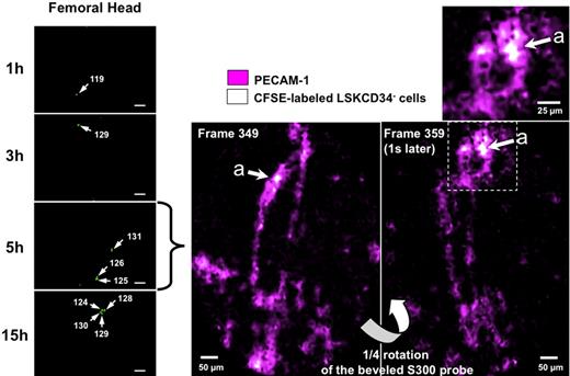 Figure 3. Early association of transplanted LSKCD34− hematopoietic cells with vascularized structures. (Left panel) At 24 hours after irradiation at 10 Gy, C57BL/6 recipient mice were transplanted with 1000 LSKCD34− CFSE-labeled cells. One, 3, 5, and 15 hours after transplantation, videos of the hematopoietic reconstitution were performed on the femurs of 3 different mice. Pictures taken over time are representative of the very few frames of the femoral head that contain single cells. Scale bar represents 50 μm. White arrows indicate individual cells, and the fluorescence intensity of these single cells is shown. (Right panel) At the time of irradiation, 30 μg of fluorescent anti–PECAM-1 or anti-IgG isotype antibodies was injected into recipient mice; and 24 hours later, these mice were transplanted with 1000 LSKCD34− CFSE-labeled cells. Five hours after transplantation, videos of the hematopoietic reconstitution were performed on the femurs of 3 different mice. Pictures obtained with the fluorescent anti–PECAM-1 antibodies and the LSKCD34− CFSE-labeled cells represent selected frames (from 349 and 359) of the femoral head. The top window represents a 2-fold enlargement of the indicated femoral area showing CFSE-labeled hematopoietic cells in the vicinity of PECAM-1+ cells.