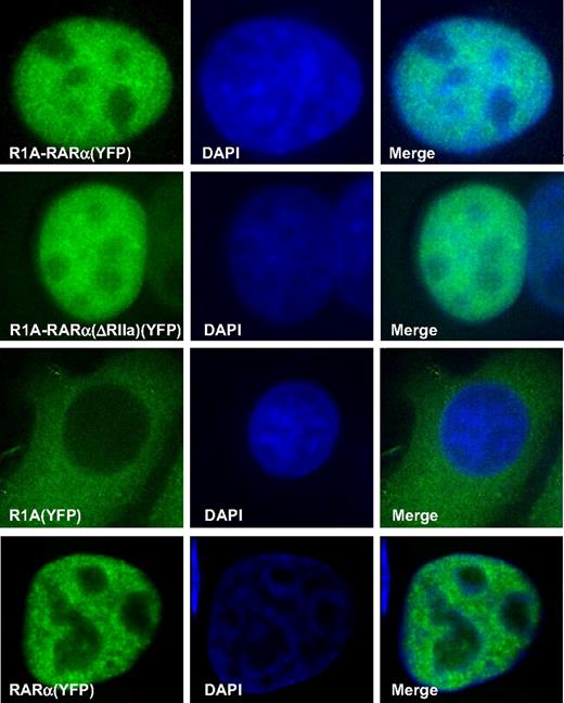 Figure 4. Cellular localization of RARα-containing proteins. Deconvolution fluorescence microscopy was used to analyze HeLa cells transiently transfected with the indicated YFP-tagged proteins, R1A-RARα, R1A-RARα(ΔRIIa), wild-type R1A, or wild-type RARα. Nuclei were visualized by counterstaining with DAPI (blue), and representative cells are shown.