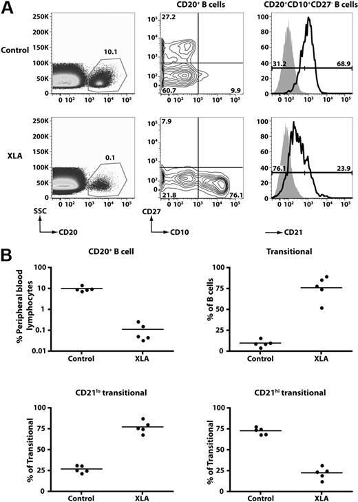 Figure 4. CD21lo transitional B cells are the predominant B-cell population in the blood of B-cell–deficient XLA patients. (A) PBMCs from a healthy donor and an XLA patient were stained with anti-CD20, -CD27, -CD10, and -CD21 mAbs. (Left panel) The frequency of CD20+ B cells; these cells were divided into transitional, naive, and memory B-cell subsets based on differential expression of CD10 and CD27 (middle panel). The transitional B cells were further divided into CD21lo and CD21hi subsets. The histograms presented for CD21 expression (right-hand panel) were obtained by gating on the CD20+CD10+CD27− B cells (which appear in the lower right-hand quadrant of the contour plot depicted as the middle panel). The overlay solid gray histogram represents the fluorescence of lymphocytes incubated with an isotype control mAb. Flow-cytometric analysis of transitional B-cell subsets detected in donors and XLA patients was performed on the same day with identical instrument settings. The values in each plot are the mean percentages of each of the indicated B-cell subsets from all studied healthy donors and patients. (B) Summary of the frequency of total B cells, transitional B cells, and transitional B-cell subsets in healthy donors (HD) and XLA (n = 5).