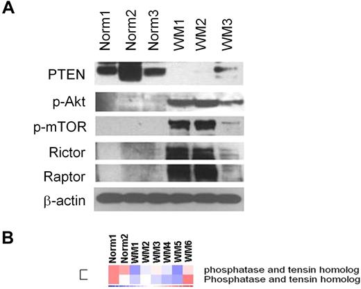 Figure 1. Primary WM cells are characterized by low expression of PTEN and high expression of p-Akt and p-mTOR, compared with their normal cellular counterpart. (A) Immunoblotting for PTEN, p-Akt, p-mTOR, rictor, raptor, and β-actin expression in BM-derived CD19+ WM primary cells (WM), compared with normal primary CD19+ cells (Norm). (B) Purified cRNA (15 μg) isolated from primary BM-derived CD19+ WM primary cells (WM) and normal primary CD19+ cells (Norm) was hybridized to HG-U133Plus2.0 GeneChip (Affimetrix). Fold change is shown by the intensity of induction (red) or suppression (blue).