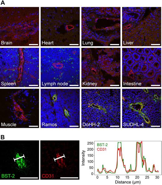 Figure 4. Expression of BST-2 in normal mouse organs and lymphoma xenografts. (A) Three-color confocal images of BST-2 staining (clone 129c, green), CD31 staining (red), and 4,6-diamidino-2-phenylindole counterstaining (blue) are shown. Although being undetectable in the vasculature of brain, heart, lung, liver, spleen, lymph nodes, kidney, intestine, and skeletal muscle, BST-2 was readily detectable in different lymphoma xenografts (Ramos, DoHH-2, SUDHL-4) in the same experiment, colocalizing to CD31 (yellow). As expected, a scattered cellular, but not vascular, expression of BST-2 was observed in lymphoid tissues. (B) Graphs displaying the spatial distribution of BST-2 and CD31 fluorescent signals in confocal microscopy were virtually superimposable. Scale bars represent 50 μm. Slides were viewed with an LSM510 Meta confocal microscope (Carl Zeiss) using 10×/0.45 W and 40×/1.2 W water objectives and Fluorescent Mounting Medium (Dako). Images were acquired with the LSM510 Meta confocal laser scanning microscope and software provided by the manufacturer (Carl Zeiss). Images were manipulated using ImageJ software, Version 1.42q (available at http://rsb.info.nih.gov/ij/).