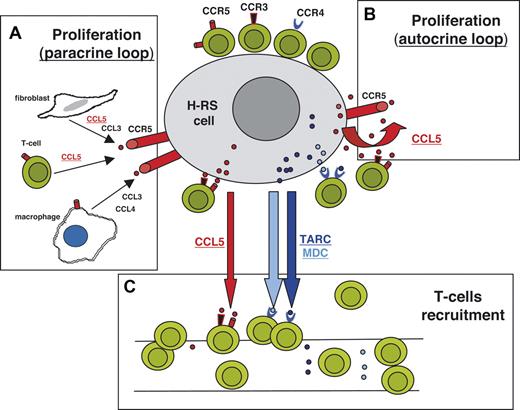 Figure 1. Schematic illustration showing the involvement of TARC, MDC, and CCL5 in microenvironment formation and RS cell growth. (A) The production of CCR5 ligands (CCL5, CCL3, and CCL4) by T cells, macrophages and fibroblasts may contribute to RS cells' proliferation (paracrine loop). (B) CCL5 produced by RS cells may represent an autocrine growth factor. (C) CCL5 produced by RS cells, together with TARC and MDC, may recruit CCR5+, CCR4+, or CCR3+ T cells.