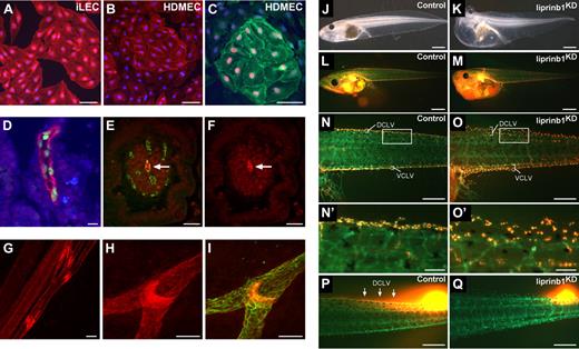Figure 2. Liprin β1 is expressed in lymphatic endothelial cells and mediates lymphatic vessel integrity. (A-B) Immunofluorescent staining of iLECs (A) and HDMECs (B) for liprin β1 (red) and DAPI (blue). HDMECs are mixed dermal endothelial cell populations containing both LECs and BECs. Bars represent 50 μm. (C) Immunofluorescent staining of HDMECs for liprin β1 (green), PROX1 (red), and DAPI (blue). HDMECs are mixed dermal endothelial cell populations containing both LECs and BECs. Bar represents 50 μm. (D) Liprin β1 is expressed in human small intestinal lacteals. Liprin β1 (red), PROX1 (green), and DAPI (blue). Bar represents 20 μm. (E-F) Blood capillaries in small intestinal villi do not express liprin β1. Immunofluorescent staining of liprin β1 (red) and VE-cadherin (green). Arrow indicates lacteal. Bars represent 50 μm. (G-I) Whole-mount immunofluorescent staining of the mouse mesentery at P5 for liprin β1 (red) and VEGFR-3 (green). Note the high liprin β1 expression in lymphatic valves. Bars represent 100 μm. (J-K) Liprin β1 knockdown in Xenopus tadpoles results in edema formation. Tadpoles are from stage 45. Bar represents 1000 μm. (L-O′) Impaired assembly of DCLVs and ventral caudal lymph vessels (VCLVs) in stage 46 liprin β1-morphants of the Tg(Flk1:eGFP) transgenic line. Lymphatic endothelial cells are identified by the uptake of TRITC-dextran after intracardial injection and extravasation from blood vessels, whereas blood vessels express only GFP. Note grossly normal blood vascular assembly. (N′-O′) Close-up view of DCLVs from panels N-O. Bars represent the following: L-M, 1000 μm; N-O, 500 μm; N′-O′, 100 μm. (P-Q) Impaired drainage of locally injected fluorescent TRITC-dextran dye after liprin β1 knockdown. Arrows indicate normal dye drainage in control tadpoles. Tadpoles are at stage 46. Bar represents 500 μm.