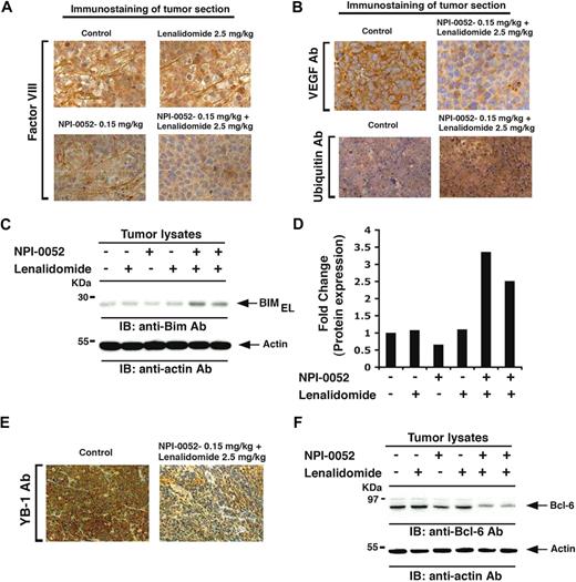 Figure 7. Effect of NPI-0052 plus lenalidomide on neovascularization, ubiquitination, BIM, Bcl-6, and YB-1 in vivo in xenografted MM tumors. Tumor sections from mice receiving indicated treatment were immunostained with factor VIII (A), VEGFR1, or ubiquitin Abs (B). (C) Tumor lysates from control and drug-treated mice were subjected to immunoblot analysis using anti-BIM or antiactin Abs. Lanes 1 through 6 represent tumor lysates from mice receiving the following treatments: lane 1, vehicle alone (control); lane 2, NPI-0052 (0.15 mg/kg); lane 3, lenalidomide (2.5 mg/kg); lane 4, lenalidomide (5.0 mg/kg); lane 5, NPI-0052 (0.15 mg/kg) plus lenalidomide (2.5 mg/kg); and lane 6, NPI-0052 (0.15 mg/kg) plus lenalidomide (5.0 mg/kg). (D) Bar graph represents quantification of BIMEL protein bands in immunoblot shown in Figure 4C by densitometry: a 3.3-fold increase in BIMEL isoform was noted in NPI-0052 plus lenalidomide–treated versus untreated cells. Samples were normalized to actin. (E) Tumor sections from control and NPI-0052 plus lenalidomide–treated mice were immunostained with YB-1 Ab. (F) Tumor lysates from control and drug-treated mice were subjected to immunoblot analysis using anti–Bcl-6 or antiactin Abs. Lanes 1 through 6 are the same as in panel C. (A-B,E) Representative of similar observations in 2 different mice receiving the same treatment. For panels A, B, and E, images were obtained with a Zeiss Axioimager M1 microscope (63×/1.4 Plan-Apochromat objective), a AxioCam HRc camera, Axiovision Version 4.6 software, and permount imaging solution.
