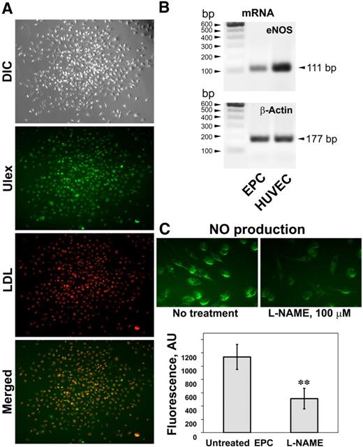 Figure 1. Functional characterization of EPCs isolated from PBMCs. (A) A typical EPC colony formed after culturing PBMCs on fibronectin in Endocult medium followed by EGM-2 medium and appearance after staining cells with the endothelial markers DiI-acetylated LDL and FITC-Ulex-lectin. Both endothelial markers are colocalized in the majority of cells. (B) Expression of the eNOS mRNA in the isolated colony-forming cells and HUVECs. (C) NO production in the cells within the colonies monitored by live imaging of NO with the NO-specific fluorescent probe DAF-FM diacetate (top panel). Fluorescence of NO-specific probe was sensitive to L-NAME, an inhibitor of nitric oxide synthase. Values are means ± SD (n = 3). **P < .01 compared with untreated cells.