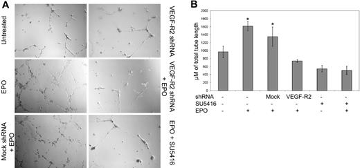Figure 5. EPO-induced tube formation is dependent on VEGF-R2. EPCs obtained from healthy control subjects were left untreated or transfected with mock shRNA or shRNA specific for VEGFR2 24 hours before plating with HUVECs on a precoated tissue culture plate and adding EPO 50 mU/mL or EPO 50 mU/mL + SU5416 1μM as indicated. (A) After 12 hours, an inverted phase-contrast microscope was used to visualize 4 randomly selected low-powered fields. (B) Tube length (mean ± SD) is shown, and the shRNA transfected and treatment with EPO or SU5416 is indicated, representative of 2 different experiments. *P < .001 compared with untreated cells.