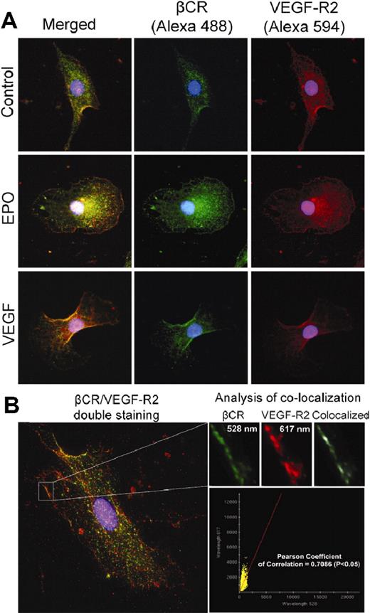 Figure 6. VEGF-R2 interacts with the βC-R. (A) CD34+ EPCs were treated with EPO (50 mU/mL) or VEGF (100 ng/mL) or mock-treated for 3 hours before fixation. Cells were stained with VEGF-R2 and βC-R antibodies before probing with secondary antibodies and imaging by confocal microscopy. (B) Spatial analysis of localization of βC-R and VEGF-R2 demonstrates colocalization.