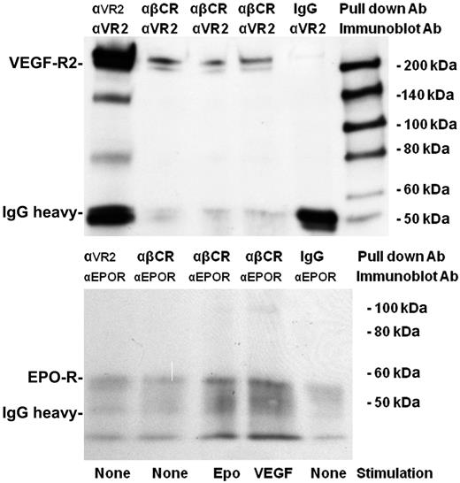 Figure 7. Coimmunoprecipitation demonstrating interactions between βC-R with VEGF-R2 and EPO-R. CD34+ EPCs were treated with EPO (50 mU/mL) or VEGF (100 ng/mL) or mock-treated for 3 hours before lysing the cells and immunoprecipitating with an αVEGF-R2 rabbit IgG (10 μg/mL), an αβC-R mouse IgG2b (2 μg/mL), or a mouse IgG2b (20 μg/mL). The immunoprecipitated products were separated by SDS-PAGE, transferred to nitrocellulose, and probed with an αVEGF-R2 antibody, followed by membrane stripping and reprobing with EPO-R antibody.