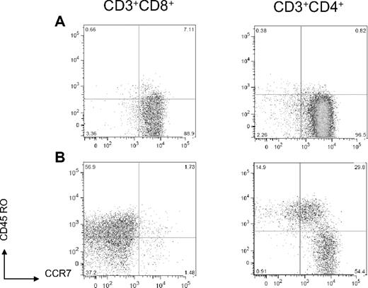 Figure 1. Conversion from naive to effector/effector memory T-cell phenotype after double-cord CBT. (A) CD8+ and CD4+ T cells in a representative unmanipulated fresh cord blood express a naive phenotype (CCR7+CD45RO−). (B) In a representative sample of day 14 posttransplantation PBMCs, CD8+ T cells express a primarily effector/effector memory phenotype (CCR7−CD45RO+/−), and CD4+ T cells express primarily naive (CCR7+CD45RO−) and central memory (CCR7+CD45RO+) phenotypes.