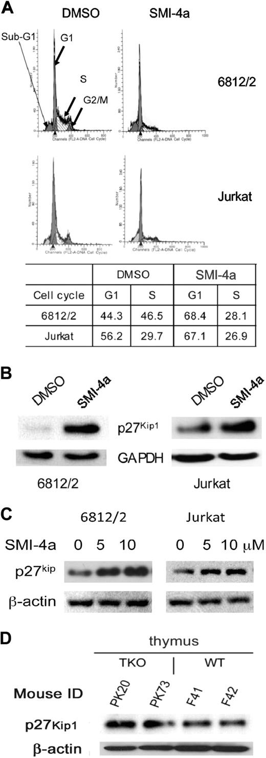 Figure 2. SMI-4a inhibition of Pim protein kinase induces cell-cycle arrest in pre–T-LBL. (A) 6812/2 cells were incubated for 24 hours and Jurkat cells for 48 hours with SMI-4a (10μM) or DMSO in serum-free medium. Propidium iodide staining of these cells was followed by cell-cycle quantification performed using flow cytometric analysis. (B) The effect of 24 hours of treatment with SMI-4a (10μM). After treatment of 6812/2 and Jurkat, the cellular levels of p27Kip1 were measured by Western blotting using antibodies to this protein and glyceraldehyde-3-phosphate dehydrogenase (GAPDH) as a loading control. (C) 6812/2 and Jurkat cells were incubated with increasing doses of SMI-4a for 24 hours in serum-free medium, and the level of p27Kip1 was measured by SDS-PAGE followed by Western blotting using β-actin antibodies as a protein loading control. (D) The thymus was harvested from 2 Pim1/2/3 triple knockout (TKO) mice and WT-FVB mouse controls. Extracts of these organs were Western blotted with antibodies to p27Kip1 and β-actin.