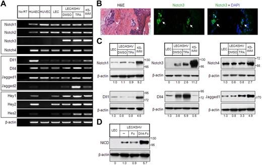 Figure 1. Expression of Notch pathway genes in KS cells. (A) Expression of Notch receptors (top panel), Notch ligands (middle panel), and Notch pathway downstream target genes (bottom panel) in endothelial cells and KS cells was analyzed by RT-PCR. HUAECs, HUVECs, and LECs were included as controls. KSHV-infected LECs (LEC/KSHV) were treated with TPA (25 ng/mL) or dimethyl sulfoxide (DMSO) for 48 hours before harvest. KS-IMM was a tumor cell line isolated from KS lesion.22 β-Actin expression indicates that an equal amount of RNA was used to perform PCR. (B) Expression of Notch3 in human KS tumor tissue was analyzed by immunostaining. The KS tumor regions are indicated by arrows. (C) Expression of Notch receptors and Notch ligands in KS cells were analyzed by Western blot. The relative expression level was quantitated by ImageJ (National Institutes of Health), normalized to β-actin, and is shown below each panel. (D) sDll4-Fc or human Fc fragment was clustered with anti-Fc antibody (1:1 ratio) at room temperature for 60 minutes. LEC/KSHV cells were then treated with clustered sDll4-Fc or Fc fragment (1 μg/mL) for 90 minutes, and whole cell lysate was subjected to Western blot with antibody against activated Notch.