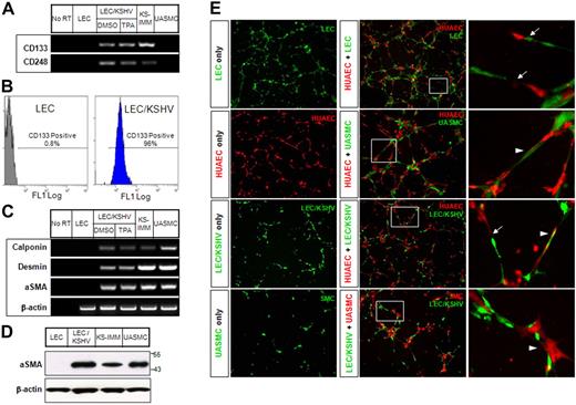Figure 2. KS cells have both endothelial and mural cell characteristics. (A) Expression of endothelial progenitor markers (CD133 and CD248) in KS cells was analyzed by RT-PCR. (B) LECs and LEC/KSHV cells were sorted for cell surface CD133 expression by flow cytometry. (C) Expression of mural cell markers (calponin, desmin, and α-SMA) in KS cells was analyzed by RT-PCR. Human UASMCs were used as positive control for mural cell markers. (D) Western blots analysis for α-SMA expression in KS cells. (E) Cells were labeled with green or orange CellTracker and cultured on Matrigel for 6 hours, alone or in various combinations. (Right panel) Enlarged boxed area in the middle panel. Arrows point to the tubes formed by integration of 2 types of endothelial cells. Arrowheads point to the endothelial cells lined with mural cells.