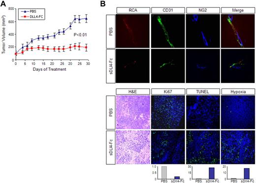 Figure 6. sDll4-Fc inhibits KS tumor growth in vivo. (A) Athymic mice were implanted with 2 × 106 KS-IMM cells. When tumor sizes were approximately 100 mm3, mice were randomly assigned to treatment groups (6 per group) (day 0). Mice were treated by intraperitoneal injection of sDll4-Fc (10 mg/kg) or PBS, 3 times a week for 31 days. Tumor volume was measured 3 times a week. The P value was calculated by Student t test. (B) Just before tissue harvest, mice were infused with RCA-Lectin and hypoxyprobe. Tumor tissue structure was examined by hematoxylin and eosin staining. Perfused vessels were localized by RCA-Lectin, microvascular endothelial cells were localized by CD31 staining, and pericytes were localized by NG2 staining. Nuclei were counterstained with 6-diamidino-2-phenylindole dihydrochloride. Proliferating cells within the tumor were assessed by immunostaining with anti-Ki67 antibody. Apoptosis was examined with TUNEL assay. Hypoxia was assessed by immunostaining with anti-Hypoxyprobe antibody. Quantitation was performed with the use of Bioquant Image Analysis (Bioquant), and the relative fluorescence level is shown below the panel. The confocal images were taken at an original magnification ×60.