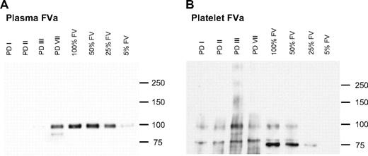 Figure 4. Immunoprecipitation of FVa from plasma and platelets. FVa was immunoprecipitated from 200 μL of plasma (A) or 200 μL of 1.5 × 108 activated platelets/mL (B), concentrated 6 times (FV-deficient patients PD I, PD II, PD III, PD VII) or not concentrated (control), and subjected to SDS–polyacrylamide gel electrophoresis and Western blotting. Control plasma and platelet FVa preparations were run at different dilutions (100%, 50%, 25%, or 5%). FVa was detected with a monoclonal anti-FV heavy chain antibody and chemiluminescence. The FVa heavy chain has a molecular weight of 105 kDa; smaller fragments (only visible in platelet FVa) are degradation products of the FVa heavy chain.
