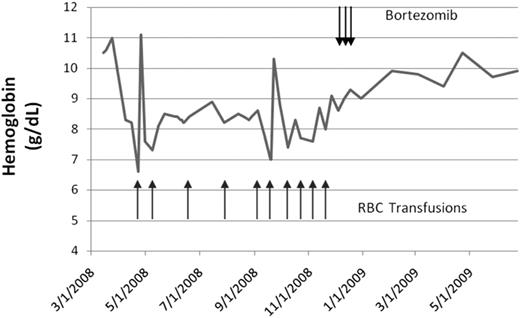 Figure 1. Hemoglobin levels. Graph of hemoglobin over time (gray line) with timing of RBC transfusions (black arrows, bottom) and bortezomib administration (black arrows, top).