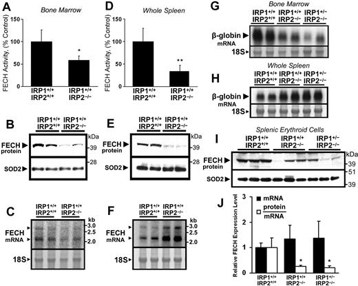 Figure 1. Posttranscriptional reduction of ferrochelatase (FECH) activity and protein levels in erythropoietic tissues of IRP2−/− mice. (A,D) FECH activity in bone marrow aspirates and whole spleens of Irp1+/+:Irp2−/− mice was significantly decreased compared with Irp1+/+:Irp2+/+ (wild-type) animals. Error bars represent SD (n = 4 animals per genotype). (B,E) FECH protein levels in bone marrow and spleen were also decreased in Irp1+/+:Irp2−/− animals. Each lane from the Western blot represents whole-tissue protein extracts pooled from 2 animals. The filter was reprobed for SOD2 as a loading control for mitochondrial matrix protein. (C,F) FECH mRNA levels were increased in the spleens of Irp1+/+:Irp2−/− mice. Messenger RNA levels were measured by Northern blot using a probe specific for both the 2.2-kb and 2.9-kb FECH transcripts; each lane represents RNA pooled equally from 2 animals. The 18S ribosomal band was visualized to assess equal loading. Results were confirmed by quantitative RT-PCR (data not shown). (G-H) To estimate the tissue distribution of erythroid cells, β-globin mRNA levels in bone marrow aspirates and spleens from Irp1+/+: Irp2+/+, Irp1+/+:Irp2−/−, and Irp1+/−:Irp2−/− mice were assessed by Northern blot. (I) FECH protein abundance in splenic TER119+ erythroid cells mice was measured by Western blot. FECH mRNA transcript levels (J, ■) were measured by quantitative RT-PCR using primers specific for both the 2.2-kb and 2.9-kb FECH transcripts; data are normalized to Irp1+/+:Irp2+/+ (wild-type) mRNA levels. Relative protein abundance was calculated by densitometry, and individual protein abundance values were normalized to the respective mRNA levels measured in the same sample (J, □). Data in panels A, D, and J were analyzed by 2-tailed Student t test; *P < .05; **P < .01.