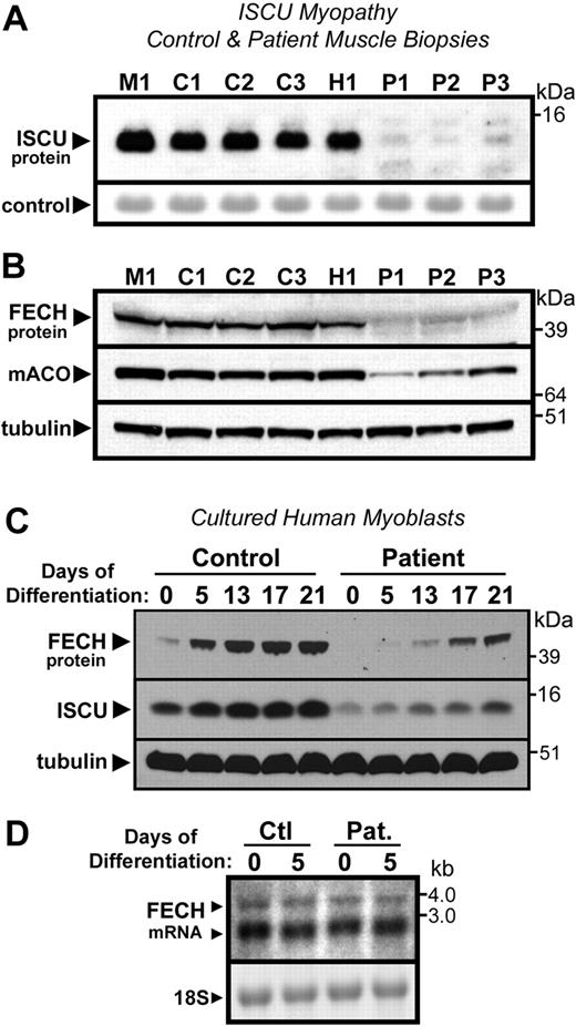 Figure 6. Disruption of Fe-S assembly in ISCU myopathy causes depletion of FECH. (A) As reported previously, total ISCU protein levels were depleted in vastus lateralis muscle biopsies taken from Swedish patients with ISCU myopathy (lanes designated as P1-P3), compared with 3 healthy controls (designated C1-C3), and a patient with an unrelated mitochondrial myopathy (designated as M1). A prominent protein band observed after Ponceau-S staining of the filter served as the loading control. (B) FECH protein levels were also greatly decreased in the ISCU myopathy biopsies, as were levels of the Fe-S cluster-containing enzyme mitochondrial aconitase. (C) Primary myotube cultures obtained from an ISCU myopathy patient as well as from a healthy person (control) were terminally differentiated by growth in low serum conditions (“Tissue biopsies and myoblast culture”). Although FECH and ISCU levels increased in both control and patient cultures during the course of the experiment, the relative level of both proteins was diminished in the patient cultures compared with the control at every given time point. (D) Little difference in FECH mRNA levels was seen in control and patient myotube cultures at zero and 5 days of differentiation, as assessed by Northern blot.