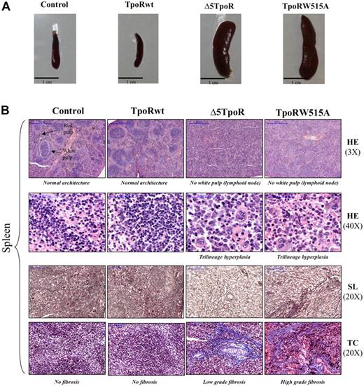 Figure 2. Histology of mice reconstituted with bone marrow–expressing TpoR variants. Bone marrow cells were infected with empty vector pMEGIX, or pMEGIX viruses coding for wild-type TpoR (TpoRwt), Δ5TpoR, or TpoRW515A mutants. (A) Splenomegaly was detected in mice expressing the active TpoR mutants compared with control empty vector or TpoRwt mice. All mice present more than 95% GFP-positive cells at 3 weeks after reconstitution. (B) Histology of spleen sections of mice reconstituted with the indicated constructs. Spleen sections are stained with hematoxylin-eosin (HE; 3× or 40× magnification), silver stain (SL; 20× magnification), or trichrome (TB; 20× magnification). Spleen sections were performed 45 days after transplantation. Microscopic section of the spleen shows expansion of the red pulp (HE, 3×). The splenic enlargement is due mainly to extramedullary hematopoiesis (HE, 40×) as well as fibrosis (SL, 20× and TC, 20×) that occur in the splenic red pulp sinusoids. Megakaryocytes are prominent, but erythropoiesis and granulopoiesis are present as well in the splenic sinuses. Both Δ5TpoR and TpoRW515A induce some degree of early fibrosis with reticulin (see silver staining: SL, 20×) and collagen deposition stained in blue by the Masson trichrome (TC, 20×). Images were obtained using a Mirax Digital Slide System.