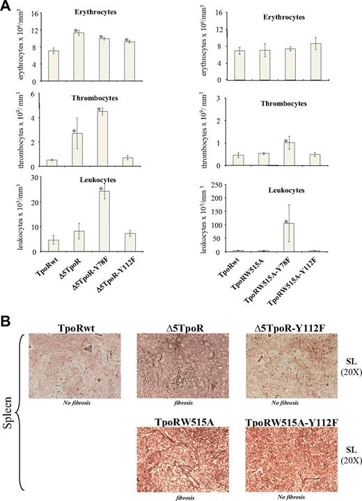 Figure 4. In vivo effects of Δ5TpoR and TpoRW515A where cytosolic tyrosine residues were substituted to phenylalanine. (A) Peripheral blood counts of mice that received a transplant of bone marrow cells expressing the indicated Δ5TpoR (left) or TpoRW515 (right) mutants at day 30 after reconstitution. All mice present more than 95% GFP-positive cells at 3 weeks after reconstitution. (B) The Y112F mutation abrogates spleen myelofibrosis induced by Δ5TpoR or TpoRW515A at day 60 after reconstitution. Silver staining of spleen sections shows the presence of reticulin fibers in spleens from mice reconstituted with Δ5TpoR or TpoRW515A, but not in spleens from mice reconstituted with Δ5TpoR-Y112F, TpoRW515A-Y112F, or TpoRwt.