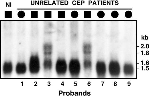 Figure 1. Northern hybridization analysis of UROS poly(A)+ RNA isolated from lymphoblasts of unrelated CEP patients. A single 1.5-kb transcript was observed for the normal person (Nl) and the CEP patients, with the exception of patients 3 and 6 who had longer transcripts of 1.6, 1.8, and 2.0 kb, suggesting that their CEP mutation(s) altered UROS pre-mRNA splicing.