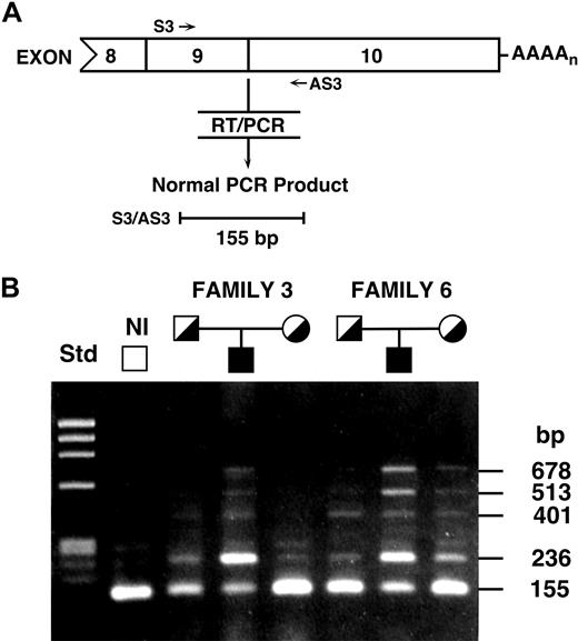 Figure 2. RT-PCR of UROS mRNAs from lymphoblasts. RT-PCR analysis of the UROS mRNAs from lymphoblasts of patients 3 and 6, their parents, and a normal person demonstrated that the presence of additional sequences between exons 9 and 10 was responsible for the larger mRNAs. (A) Schematic overview of the RT-PCR analysis of alternative splicing in intron 9. The sequences of primers S3 and AS3 are provided in supplemental Table 2. (B) Agarose gel electrophoresis and ethidium bromide staining of UROS RT-PCR products revealed the 4 longer products. Sequencing the longer amplicons in patients 3 and 6 determined their location in intron 9 and their sizes of 236, 401, 513, and 678 bp in addition to the normal 155-bp product.