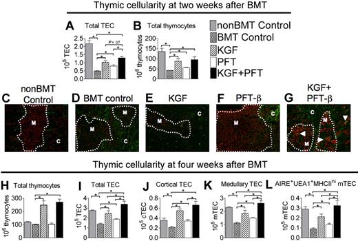 Figure 1. Combined pretreatment with KGF + PFT-β additively restores all TEC subsets by 4 weeks after congenic BMT. Lethally irradiated B6 recipients of congenic (B6 Ly5.1+) BM were left untreated (BMT Control) or pretreated with KGF, PFT-β, or KGF + PFT-β and analyzed for absolute numbers of total (A) TECs (CD45−EpCAM+MHC-II+) and (B) thymocytes (SSClowCD45+EpCAM−MHC-II−) at 2 weeks after BMT. (C-G) Immunofluorescence staining of thymic sections at 2 weeks after BMT for the cytokeratin-5, K5 (red) and Ly51 (green) identified mature cortical TECs (Ly51+K5−) and medullary TECs (Ly51−K5+). These methods were used to assess recovery of distinct cortical and medullary TEC populations. Images were acquired on an Olympus FV500 confocal microscope with the use of a 10×/0.40 objective lens with associated Olympus Software. (H) Total thymocytes, (I) total TECs, (J) cTECs (CD45− EpCAM+ MHC-II+Ly51+), (K) mTECs (CD45−EpCAM+MHC-II+Ly51−), and (L) AIRE+ mTEChi (CD45−EpCAM+UEA-1highMHC-IIhighLy51− AIRE+) were quantified in thymi from BM transplant recipients and non-BM transplant controls (nonBMT Control) at 4 weeks after BMT. For FACS analysis, data shown are the mean numbers of cells ± SEMs and are representative of 3 experiments of 4 mice per group; *P < .05. For immunofluorescence microscopy, data are representative of 2 experiments, each with 3 mice per group.