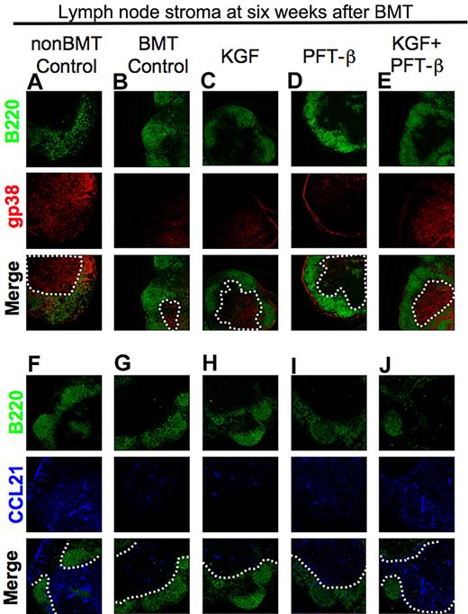 Figure 3. Combined pretreatment with KGF + PFT-β augments T-cell zone FRC and CCL21 expression after congenic BMT. (A-E) Immunofluorescence staining of peripheral LN cryosections for B220+ B cells (green) and gp38+ FRCs (red) was used to assess the relative abundance of gp38+ FRCs in T-cell zones of (A) unmanipulated, age-/sex-matched B6 control (non-BMT Controls) or BM transplant recipients that were (B) left untreated or treated with (C) KGF, (D) PFT-β, or (E) KGF + PFT-β. (F-J) Immunofluorescence staining of LNs for B220 (green) and CCL21 (blue) in (F) unmanipulated, age-/sex-matched B6 control (non-BMT Controls) or BM transplant recipients that were (G) left untreated or treated with (H) KGF, (I) PFT-β, or (J) KGF + PFT-β. In all merged images, a white, dashed line encircles the B220− T-cell zones. Data are representative of 2 experiments, each with 3 mice per group; *P < .05.