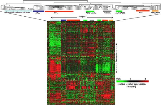 Figure 1. Normal T and NK cells, cell lines, and PTCL cases classified by unsupervised hierarchical clustering: Major entities of PTCL form tight clusters with cases of PTCL-NOS and other rare entities interspersed. Each column represents a case and each row the expression level of a gene. Gene expression level is depicted according to the color scale shown.