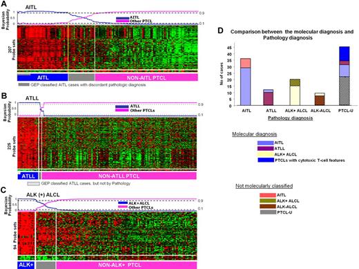Figure 2. Gene expression–based molecular predictors of the major subgroups of PTCL. (A) AITL, (B) ATLL, and (C) ALK+ ALCL. (D) The correlation between the molecular and the pathology-based diagnoses is illustrated on the right.
