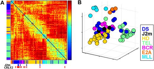 Figure 1. Unsupervised analysis of the AIEOP dataset. (A) Samples' Euclidian distance matrix. The color in each entry (y,x), where x,y = 1, …, 97 (the number of samples), represents the Euclidian distance between the expression profiles of samples x and y. It was measured after centering and normalization of each sample's expression, using 1500 probe sets with highest standard deviation. The samples are ordered by SPIN along both the x-axis and y-axis. The color bars next to both axes represent the different ALL subtypes, listed on the right of the figure. The blue marks at bottom specify DS-ALL samples with mutant JAK2 (J2m), and the red marks specify samples with high CRLF2 expression levels (CRLF2) (see “Aberrant expression of the cytokine receptor CRLF2 in DS-ALLs” section on CRLF2). (B) Projection of all samples onto the first 3 principle components of the expression. DS indicates Down syndrome ALL; J2m, Down syndrome ALL with mutated JAK2 R683; HD, high hyperdiploid; TEL, TEL-AML1; BCR, BCR-ABL; E2A, E2A-PBX1; and MLL, MLL-AF4.