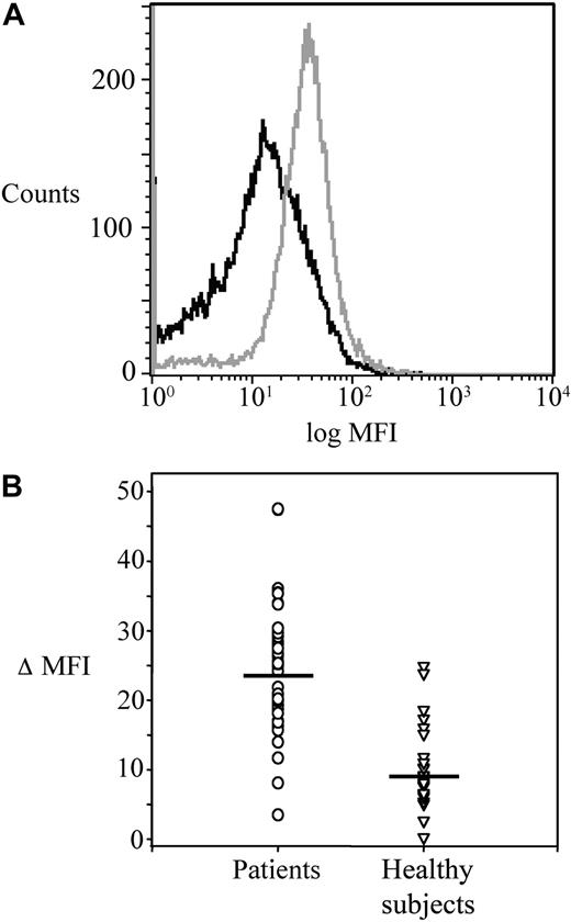 Figure 1. Platelet COX-2 expression in ET patients and healthy subjects. (A) Flow cytometric histograms of fluorescence intensity on platelets stained for COX-2 in a patient (gray) and a control subject (black). The plot of the patient is shifted to the right, indicating a higher expression of COX-2. (B) Individual values of ΔMFI (see “Platelet immunophenotyping and reticulated platelets” for details) for COX-2 in platelets from patients (n = 41) and controls (n = 22). Horizontal lines indicate medians.